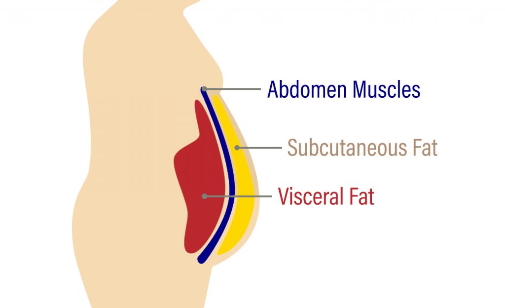 different types of fat visceral fat subcutaneous fat